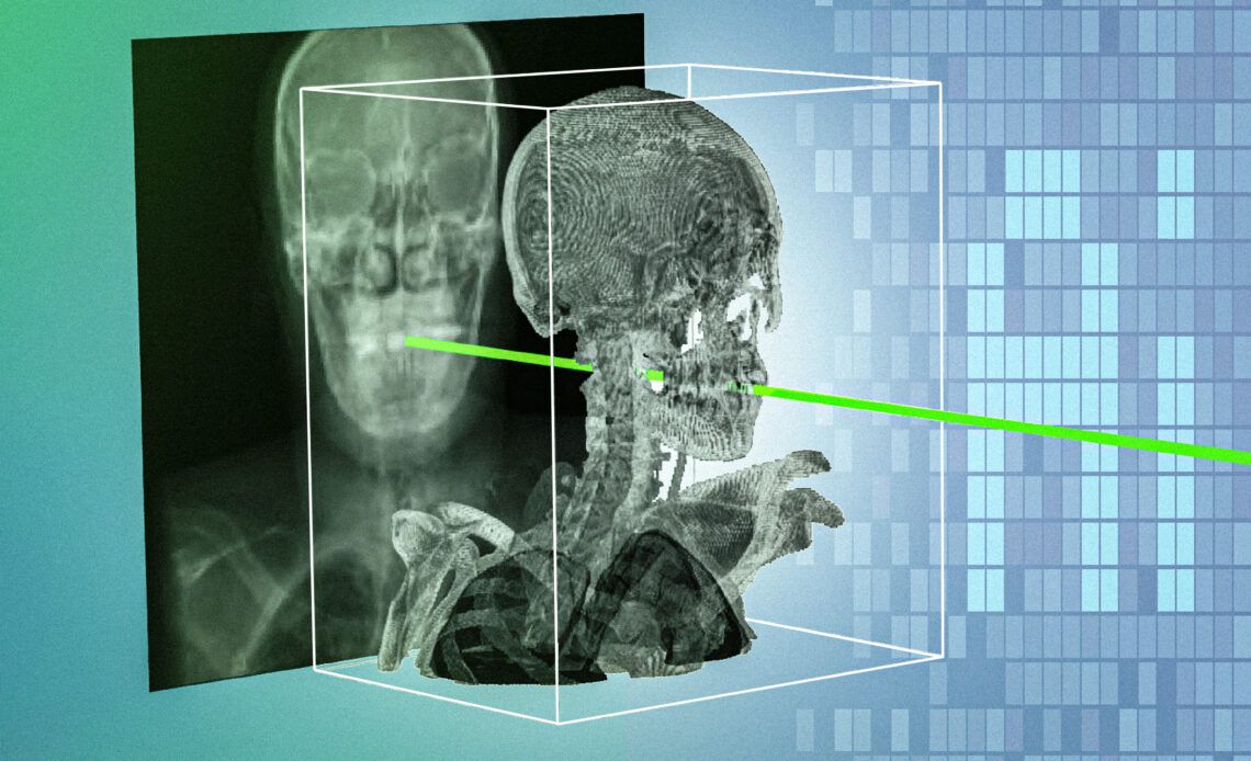 New AI technique could make minimally invasive surgeries safer and more precise | MIT News